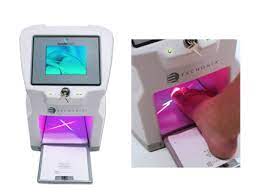 Lunula Laser fot